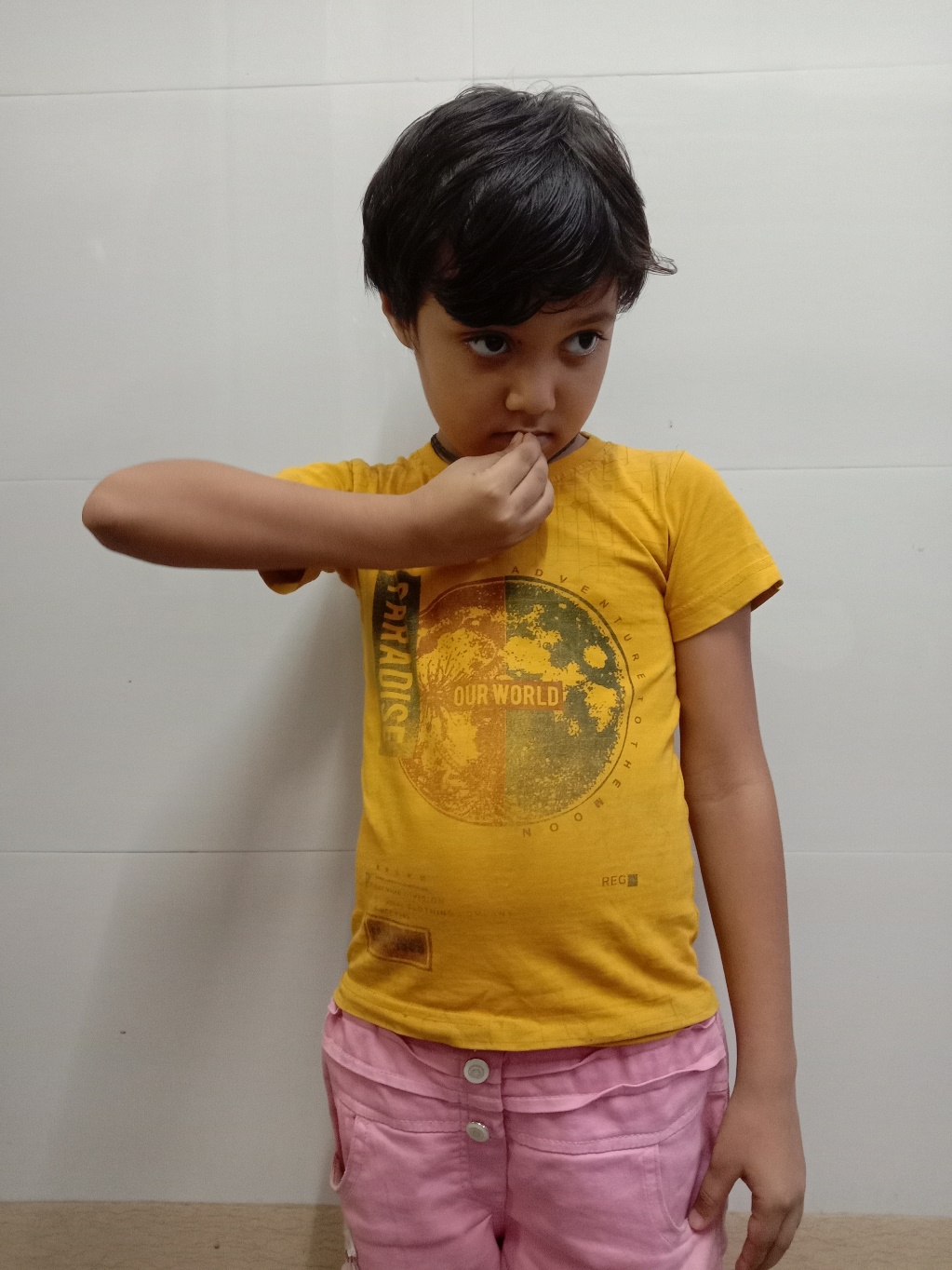 Brachial plexus palsy before treatment